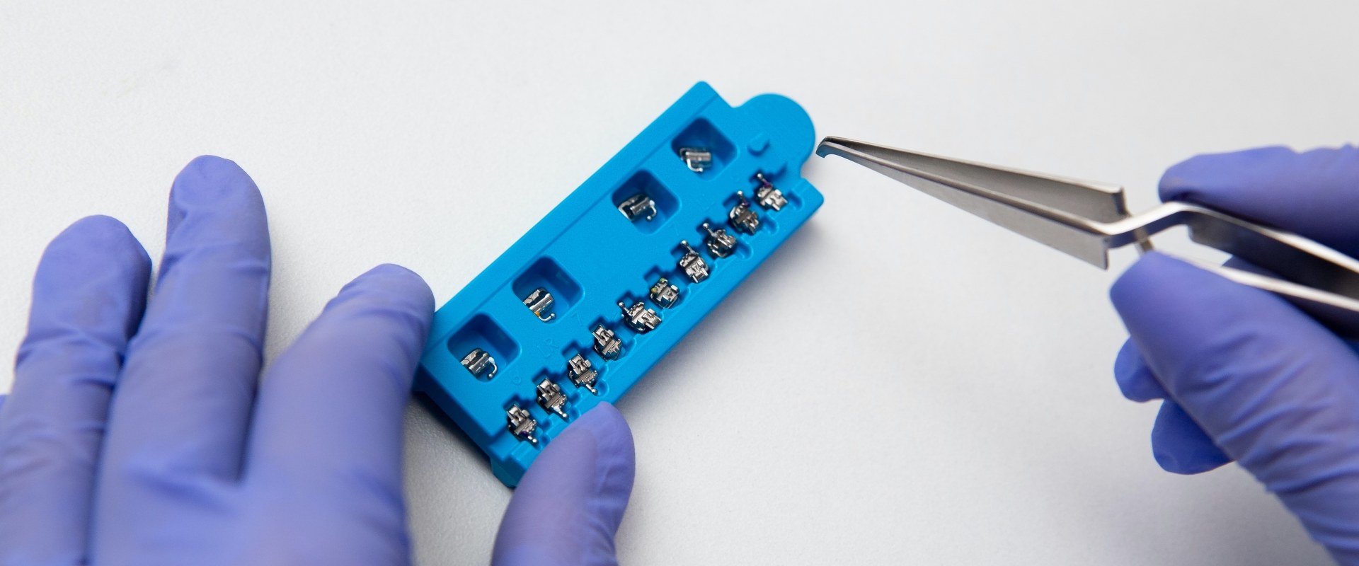 Tempe's Smile Makeover How Braces Contribute To Dental Health