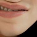What are the most common oral diseases?