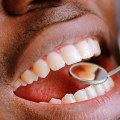 What role does oral health play in your overall health status?
