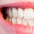 How do you know if your teeth are in good health?