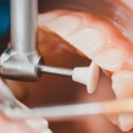 Finding Affordable Dental Health Care Treatments In Borger, TX