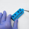 Tempe's Smile Makeover: How Braces Contribute To Dental Health