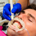 Central London Dentists: Dental Health is Just as Important