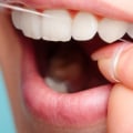 What makes good dental hygiene?