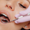 5 Benefits Of General Dentistry Services For Your Dental Health In Austin, TX