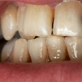 Can poor dental health make you sick?