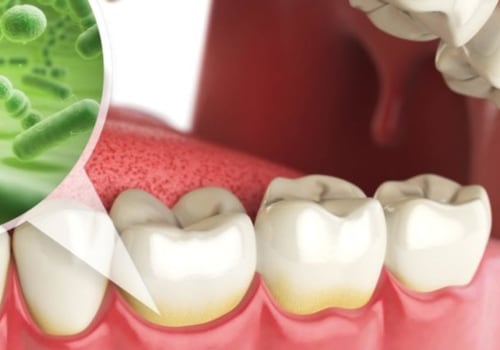 What are the types of oral hygiene?