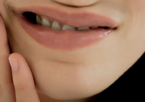 What are the most common oral diseases?