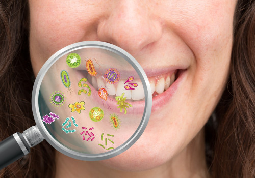 What does poor oral hygiene cause?