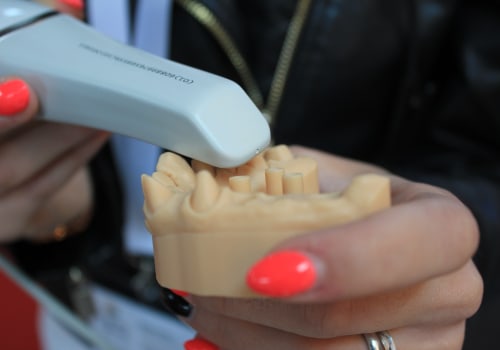 Affordable Dentures In Monroe: A Comprehensive Guide To Choosing The Right Fit For Your Dental Health