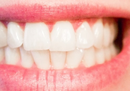 How do you know if your teeth are in good health?