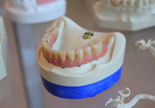 Emergency Dentist In Manassas Park: Providing Gentle And Caring Treatment For Dental Health Emergencies