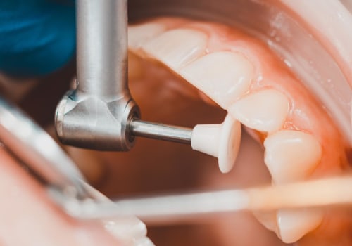 Finding Affordable Dental Health Care Treatments In Borger, TX