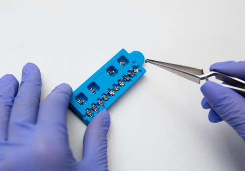 Tempe's Smile Makeover: How Braces Contribute To Dental Health