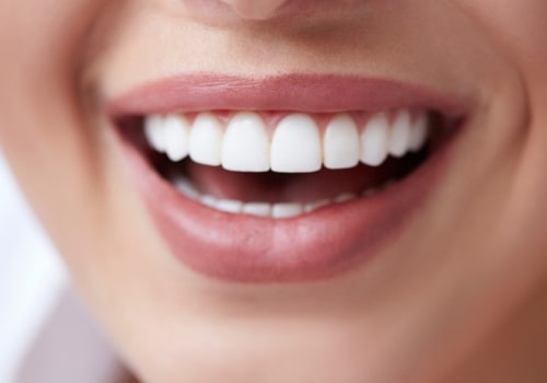 What a healthy mouth should look like?