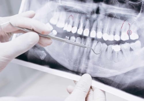 What's the difference between dentists and oral health?