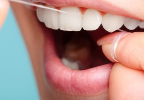 What makes good dental hygiene?