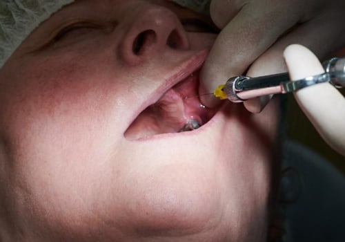 Top Reasons The Best Dental Clinic In Basel Leads In Dental Health Care