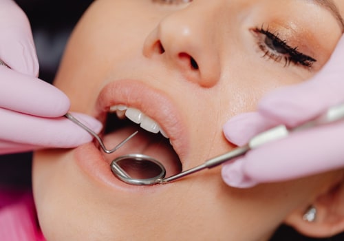 5 Benefits Of General Dentistry Services For Your Dental Health In Austin, TX