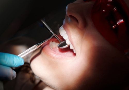 Dental Health Emergencies: Clear Aligners In Rockville, Maryland, Come To The Rescue