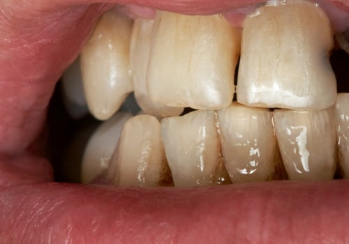 Can poor dental health make you sick?