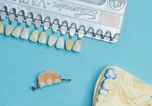 The Benefits Of Dental Crowns For Implants: Enhancing Dental Health In San Antonio, TX